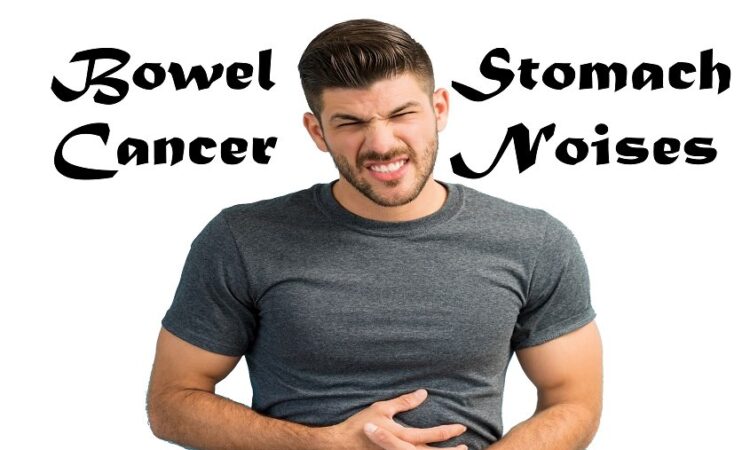 Bowel cancer stomach noises 