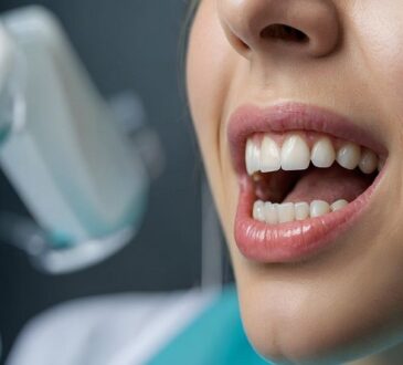 The Role of Dental Implants in Modern Dentistry